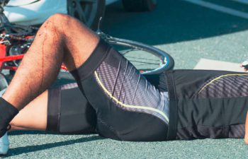 an injured cyclist after being hit by a car