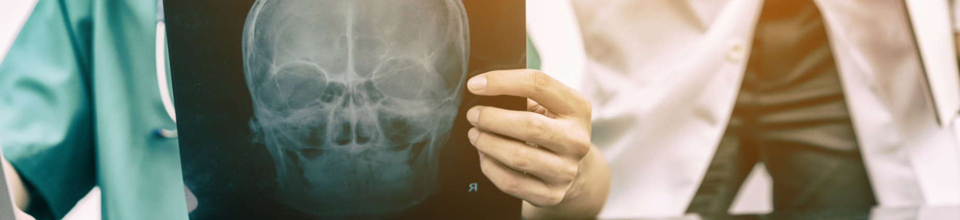 doctors revising head x-rays