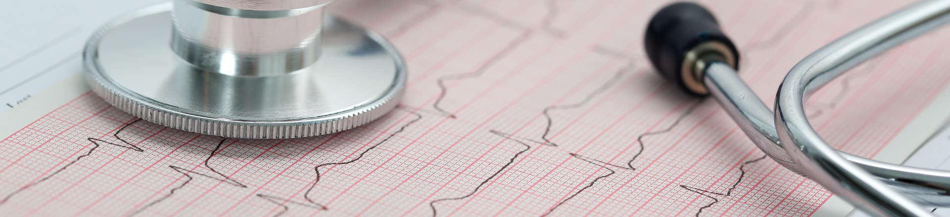 A Stethoscope and An Electrocardiogram Paper