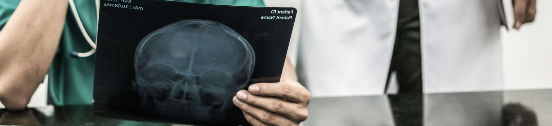 doctors revising head x-rays
