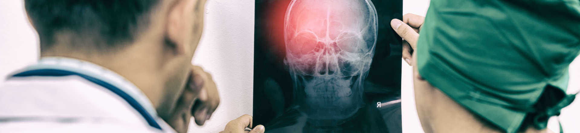 doctors revising head x-rays